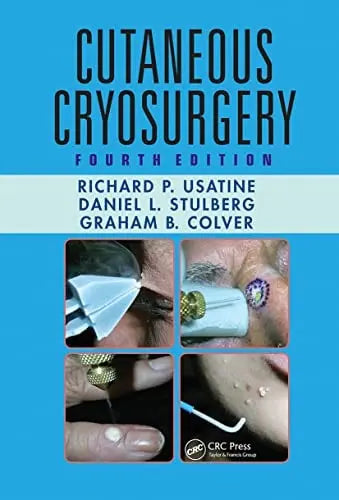 Cutaneous Cryosurgery ISBN: 978-1032243023
