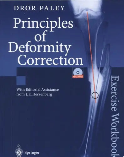 Principles of Deformity Correction Exercise Workbook by Dror Paley ISBN: 978-3540441618