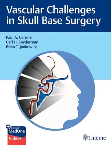 Vascular Challenges in Skull Base Surgery by Paul Gardner ISBN: 978-1684200689