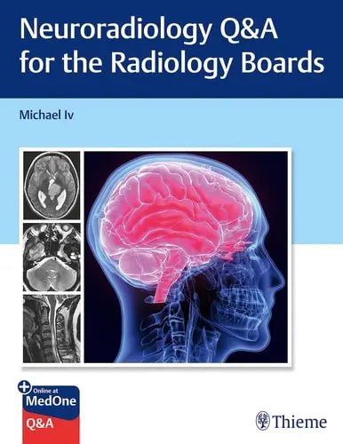 Neuroradiology Q&A for the Radiology Boards by Michael Iv ISBN: 978-1684205592