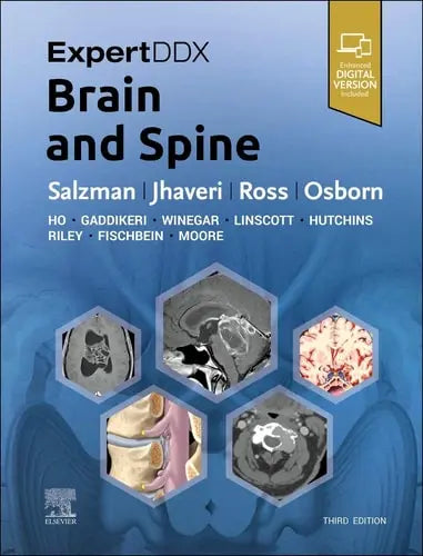 ExpertDDx: Brain and Spine by Karen L. Salzman 978-0443106941