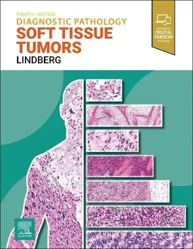 Diagnostic Pathology: Soft Tissue Tumors by Matthew R. Lindberg 978-0443109362