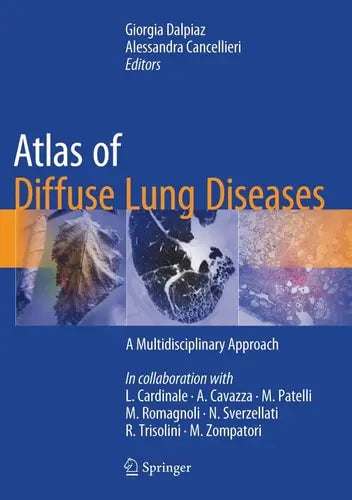 Atlas of Diffuse Lung Diseases A Multidisciplinary Approach by Giorgia Dalpiaz ISBN: 978-3319427508