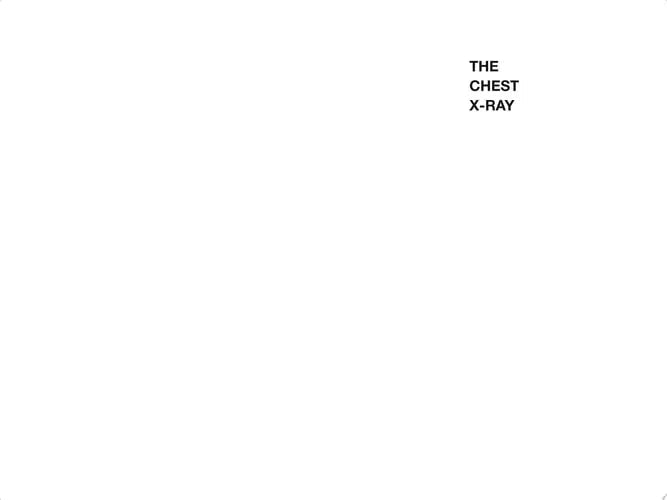 The Chest X-Ray: A Survival Guide by Gerald de Lacey 978-0702030468