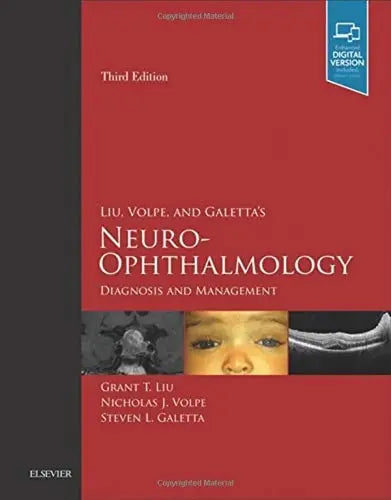 Liu, Volpe, and Galetta's Neuro-ophthalmology Diagnosis and Management by Grant T. Liu 3rd Edition ISBN 9780323340441
