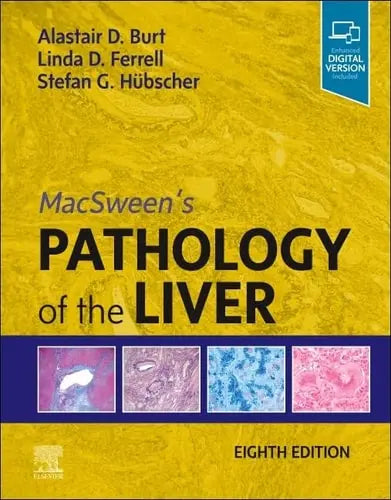 MacSween's Pathology of the Liver by Stefan G. Hübscher 978-0702082283