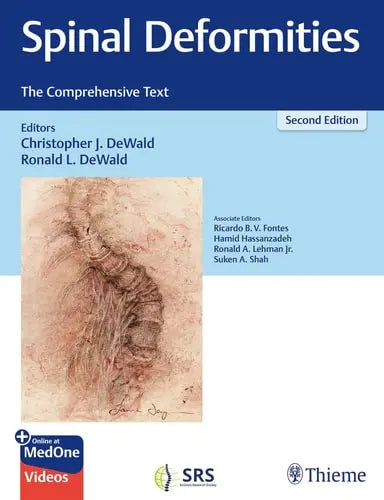 Spinal Deformities The Comprehensive Text by Christopher DeWald ISBN: 978-1626233720