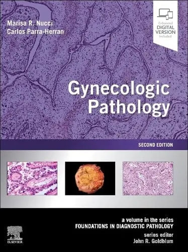 Gynecologic Pathology A Volume in Foundations in Diagnostic Pathology Series by Marisa R. Nucci 2nd Edition ISBN 9780323359092