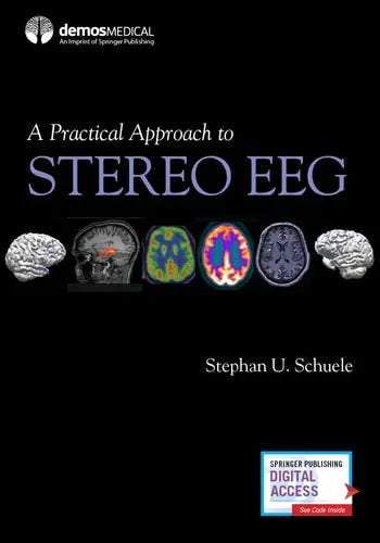 A Practical Approach to Stereo EEG by Stephan U. Schuele 978-0826136923