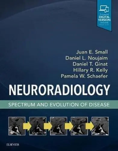 Neuroradiology: Spectrum and Evolution of Disease by Daniel L. Noujaim 1st Edition ISBN 9780323445498