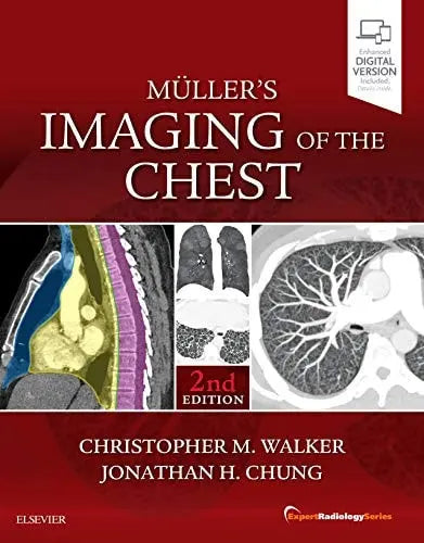 Muller's Imaging of the Chest Expert Radiology Series by Christopher M. Walker 2nd Edition ISBN 9780323462259