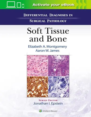 Differential Diagnoses in Surgical Pathology: Soft Tissue and Bone by Elizabeth A. Montgomery ISBN: 978-1975136024