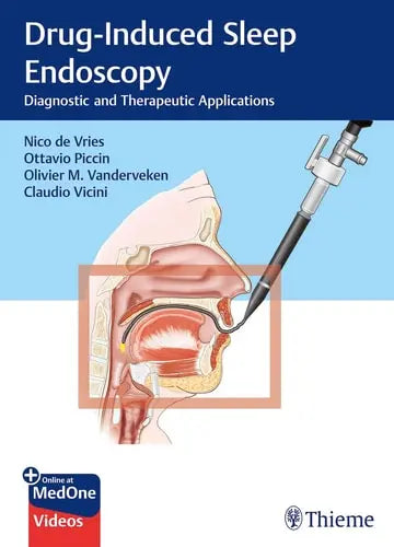 Drug-Induced Sleep Endoscopy Diagnostic and Therapeutic Applications by Nico de Vries ISBN: 978-3132403468