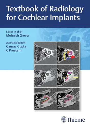Textbook of Radiology for Cochlear Implants by Mohnish Grover ISBN: 978-9392819261