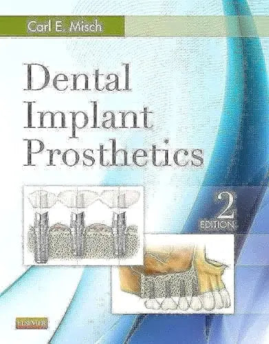 Dental Implant Prosthetics by Carl E. Misch 2nd Edition ISBN 9780323078450