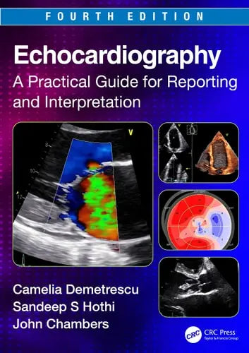 Echocardiography A Practical Guide for Reporting and Interpretation by Camelia Demetrescu ISBN: 978-1032151588