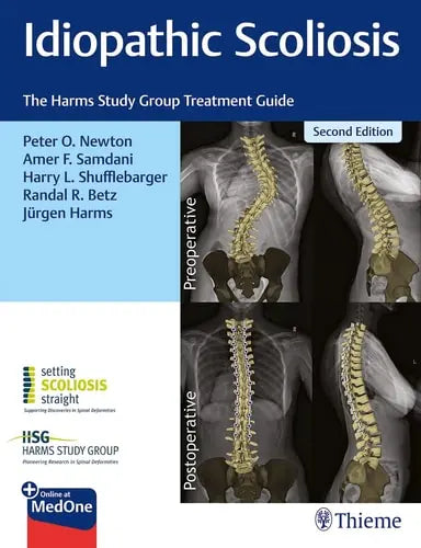 Idiopathic Scoliosis The Harms Study Group Treatment Guide by Peter O. Newton ISBN 978-1684200559