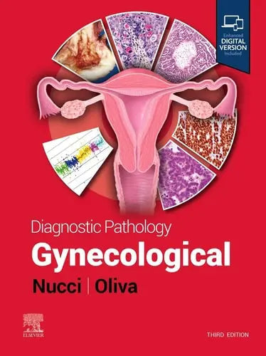 Diagnostic Pathology: Gynecological by Marisa R. Nucci 978-0443104565