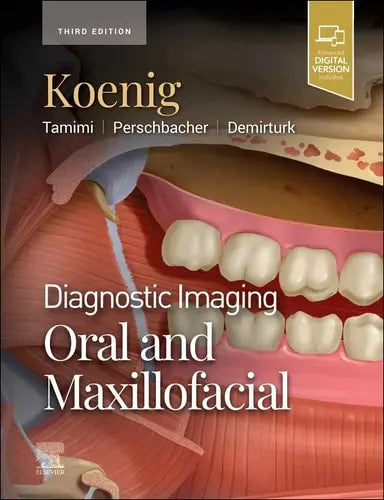 Diagnostic Imaging: Oral and Maxillofacial by Lisa J. Koenig 978-0443105319