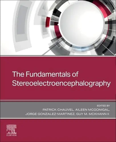 The Fundamentals of Stereoelectroencephalography by Patrick Chauvel 978-0443108778