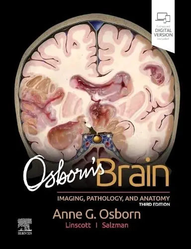 Osborn's Brain 3rd by Anne G. Osborn 978-0443109379