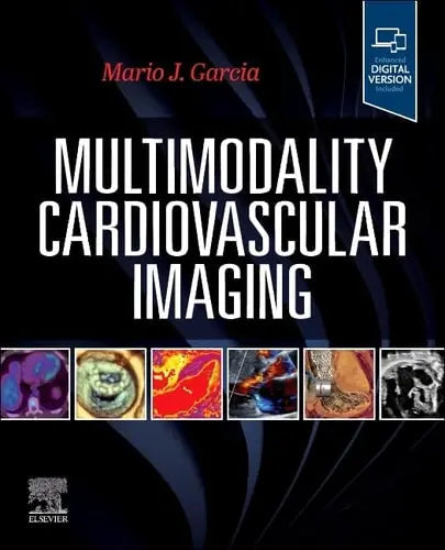 Multimodality Cardiovascular Imaging by Mario J. Garcia 978-0443115141