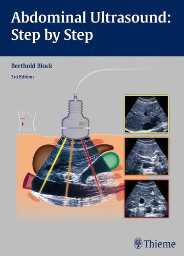 Abdominal Ultrasound Step by Step by Berthold Block ISBN: 978-3131383631