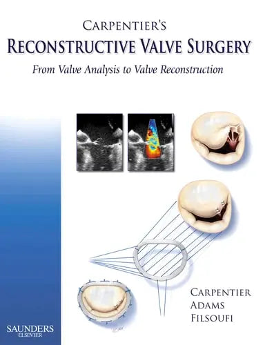 Carpentier's Reconstructive Valve Surgery From Valve Analysis to Valve Reconstruction by Alain Carpentier 978-0721691688