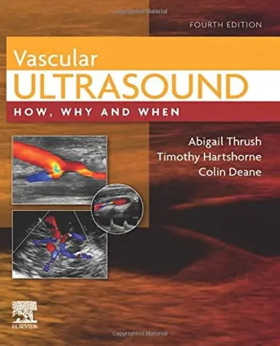 Vascular Ultrasound How, Why and When by Abigail Thrush 978-0702046568