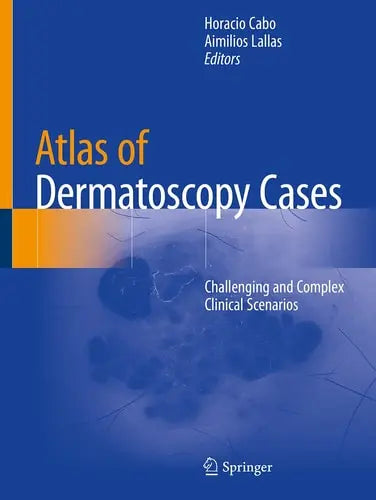 Atlas of Dermatoscopy Cases Challenging and Complex Clinical Scenarios by Horacio Cabo ISBN: 978-3030436742