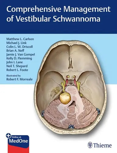 Comprehensive Management of Vestibular Schwannoma by Matthew Luke Carlson ISBN: 978-1626233317