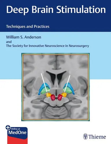 Deep Brain Stimulation Techniques and Practices by William S. Anderson ISBN: 978-1626237971