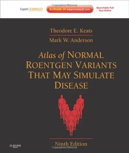 Atlas of Normal Roentgen Variants That May Simulate Disease Expert Consult - Enhanced Online Features and Print by Theodore E. Keats 9th Edition ISBN 9780323073554