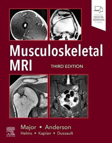 Musculoskeletal MRI by Nancy M. Major 3rd Edition ISBN 9780323415606