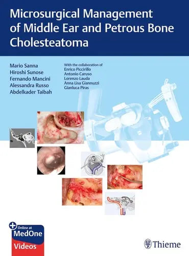 Microsurgical Management of Middle Ear and Petrous Bone Cholesteatoma by Mario Sanna ISBN: 978-3132000056