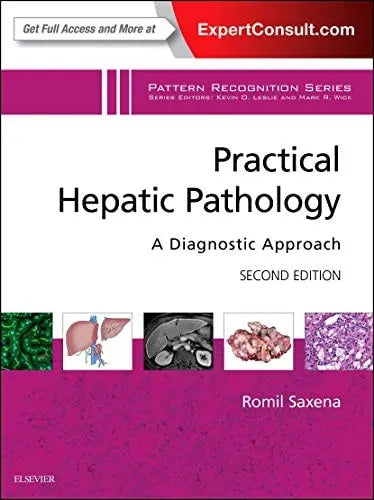 Practical Hepatic Pathology A Diagnostic Approach by Romil Saxena 2nd Edition ISBN 9780323428736