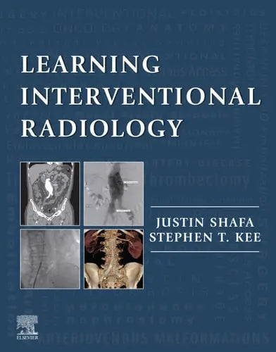 Learning Interventional Radiology ISBN 9780323478793