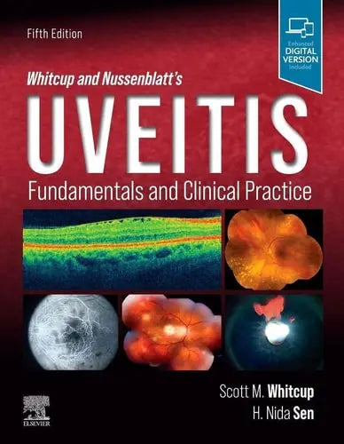 Whitcup and Nussenblatt's Uveitis Fundamentals and Clinical Practice by Scott M. Whitcup 5th Edition ISBN 9780323480147