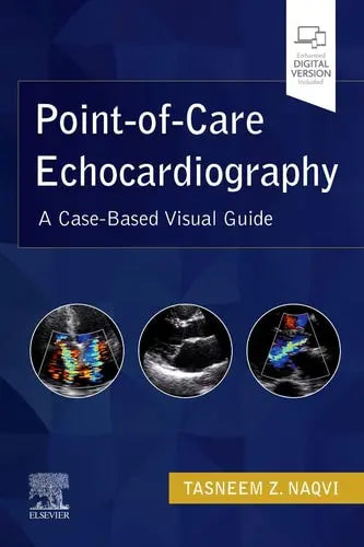 Point-Of-Care Echocardiography A Clinical Case-Based Visual Guide ISBN 9780323612845