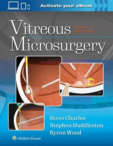 Vitreous Microsurgery by Steve Charles ISBN: 978-1975168353