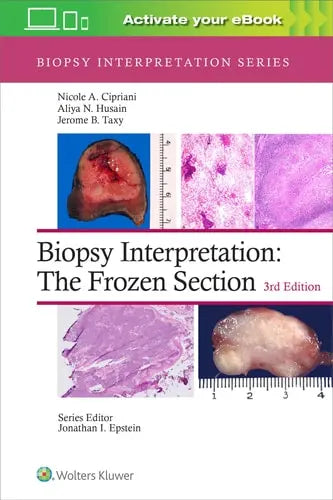 Biopsy Interpretation The Frozen Section by Nicole A. Cipriani ISBN: 978-1975170073