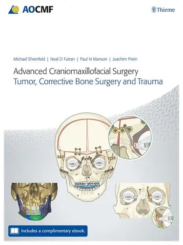 Advanced Craniomaxillofacial Surgery Tumor, Corrective Bone Surgery, and Trauma by Michael Ehrenfeld ISBN: 978-3132428393