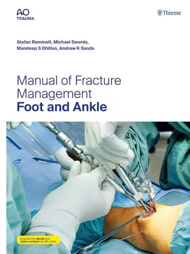 Manual of Fracture Management - Foot and Ankle by Stefan Rammelt ISBN: 978-3132434585